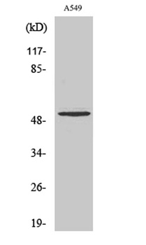 Cleaved-MMP-17 (Q129) rabbit pAb Antibody