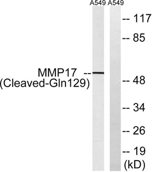 Cleaved-MMP-17 (Q129) rabbit pAb Antibody