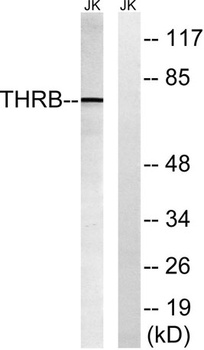 Cleaved-Thrombin APII (R327) rabbit pAb Antibody