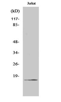 Cleaved-Factor VII LC (R212) rabbit pAb Antibody
