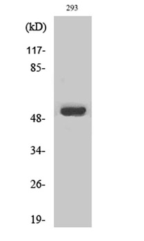 MMP-1 rabbit pAb Antibody