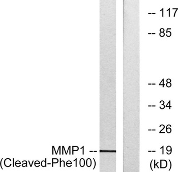 Cleaved-MMP-1 22k (F100) rabbit pAb Antibody