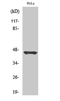 Cleaved-Plasma Kallikrein HC (R390) rabbit pAb Antibody