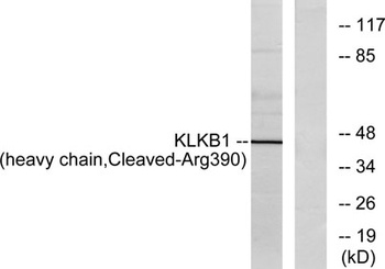 Cleaved-Plasma Kallikrein HC (R390) rabbit pAb Antibody