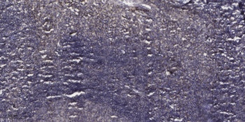 Cleaved-Plasma Kallikrein HC (R390) rabbit pAb Antibody