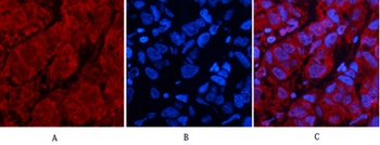 p53 (Di Methyl Lys370) rabbit pAb Antibody