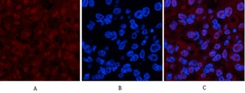 p53 (Di Methyl Lys370) rabbit pAb Antibody