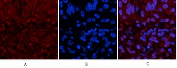 p53 (Di Methyl Lys370) rabbit pAb Antibody