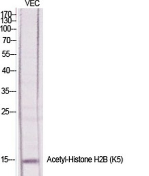 Histone H2B (Acetyl Lys5) rabbit pAb Antibody