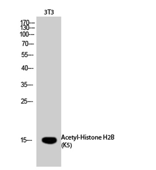 Histone H2B (Acetyl Lys5) rabbit pAb Antibody
