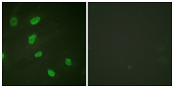 Histone H2B (Acetyl Lys5) rabbit pAb Antibody