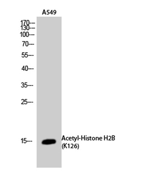 Histone H2B (Acetyl Lys126) rabbit pAb Antibody