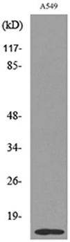 Histone H2B (Acetyl Lys126) rabbit pAb Antibody