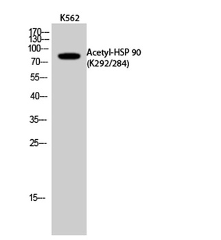 HSP 90 (Acetyl Lys292/284) rabbit pAb