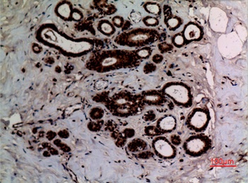 Ku-70 (Acetyl Lys542) rabbit pAb Antibody
