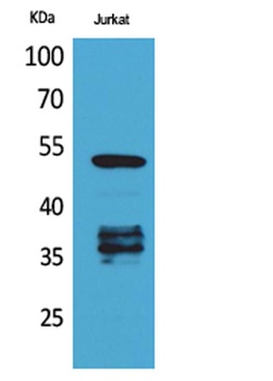 p53 (Acetyl Lys370) rabbit pAb Antibody