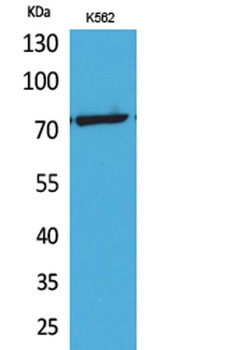 p73 (Acetyl Lys321) rabbit pAb Antibody