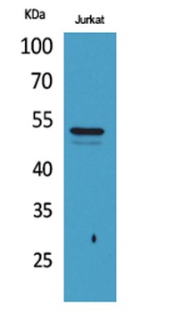 Tubulin α (Acetyl Lys40) rabbit pAb Antibody