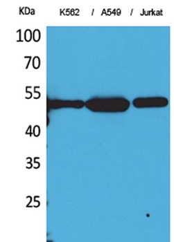 Tubulin α (Acetyl Lys352) rabbit pAb Antibody