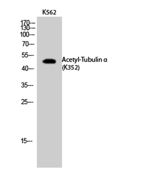 Tubulin α (Acetyl Lys352) rabbit pAb Antibody