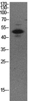 p53 (Acetyl Lys373) rabbit pAb Antibody