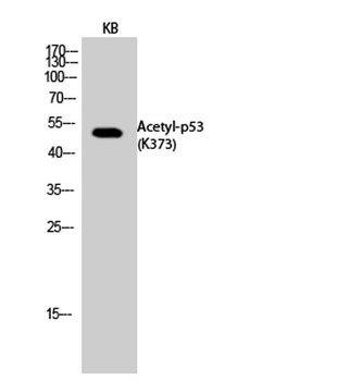 p53 (Acetyl Lys373) rabbit pAb Antibody