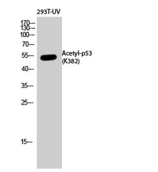 p53 (Acetyl Lys382) rabbit pAb Antibody