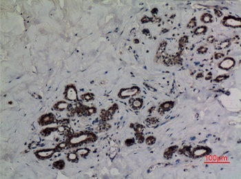 p53 (Acetyl Lys382) rabbit pAb Antibody
