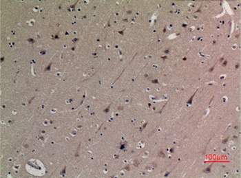 p53 (Acetyl Lys382) rabbit pAb Antibody