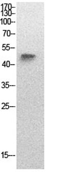 p53 (Acetyl Lys320) rabbit pAb Antibody