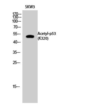 p53 (Acetyl Lys320) rabbit pAb Antibody