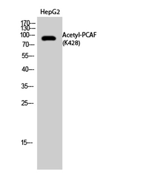 PCAF (Acetyl Lys428) rabbit pAb Antibody