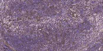 PCAF (Acetyl Lys428) rabbit pAb Antibody