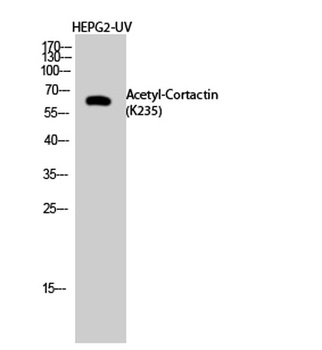 Cortactin (Acetyl Lys235) rabbit pAb Antibody