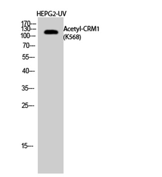 CRM1 (Acetyl Lys568) rabbit pAb Antibody