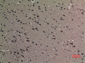 HMG-1 (Acetyl Lys12) rabbit pAb Antibody