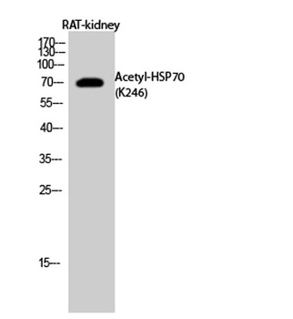 HSP70 (Acetyl Lys246) rabbit pAb Antibody