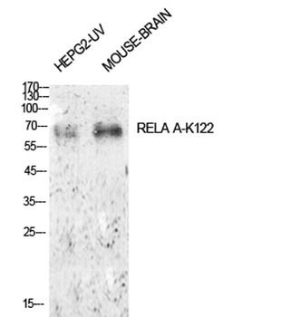 NFκB-p65 (Acetyl Lys122) rabbit pAb Antibody