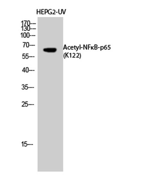 NFκB-p65 (Acetyl Lys122) rabbit pAb Antibody