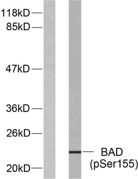 Bad (phospho Ser155) rabbit pAb