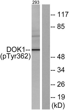 Dok-1 (phospho Tyr362) rabbit pAb