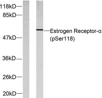 ERα (phospho Ser118) rabbit pAb
