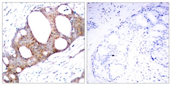 GSK3α (phospho Ser21) rabbit pAb