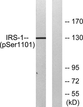 IRS-1 (phospho Ser1101) rabbit pAb