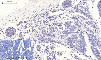 p53 (phospho Thr18) rabbit pAb