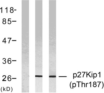 p27 (phospho Thr187) rabbit pAb