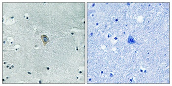 KOR-1 (phospho Ser369) rabbit pAb