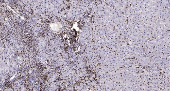 MSK1 (phospho Ser376) rabbit pAb