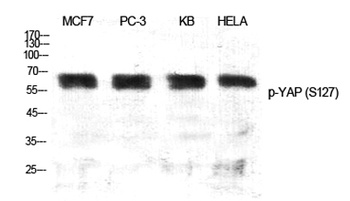 YAP (phospho Ser127) rabbit pAb