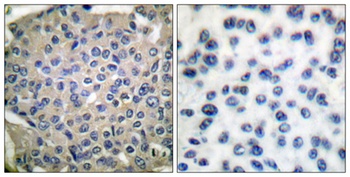 Cortactin (phospho Tyr466) rabbit pAb